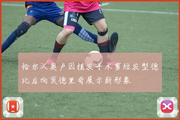 恰尔汉奥卢因植发手术剪短发型德比后向莫德里奇展示新形象